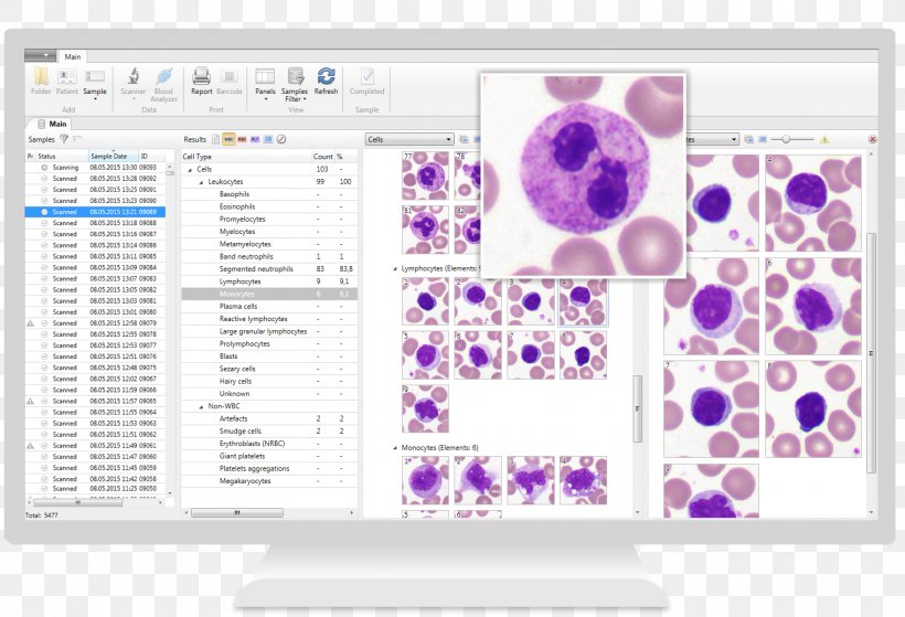 Hematology Complete Blood Count White Blood Cell Microscope, PNG, 1522x1039px, Hematology, Analysis, Area, Blood, Blood Test Download Free