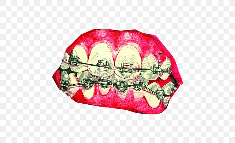 Mouth Tooth Sinful Folk: A Novel Of The Middle Ages Dental Braces, PNG, 500x500px, Mouth, Data, Data Compression, Dental Braces, Dentistry Download Free
