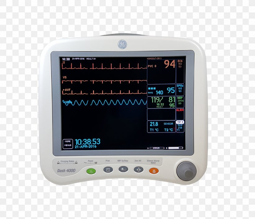 Electronics Display Device Monitoring GE Healthcare Computer Monitors, PNG, 968x834px, Electronics, Cardiac Monitoring, Computer Monitors, Display Device, Electrocardiography Download Free