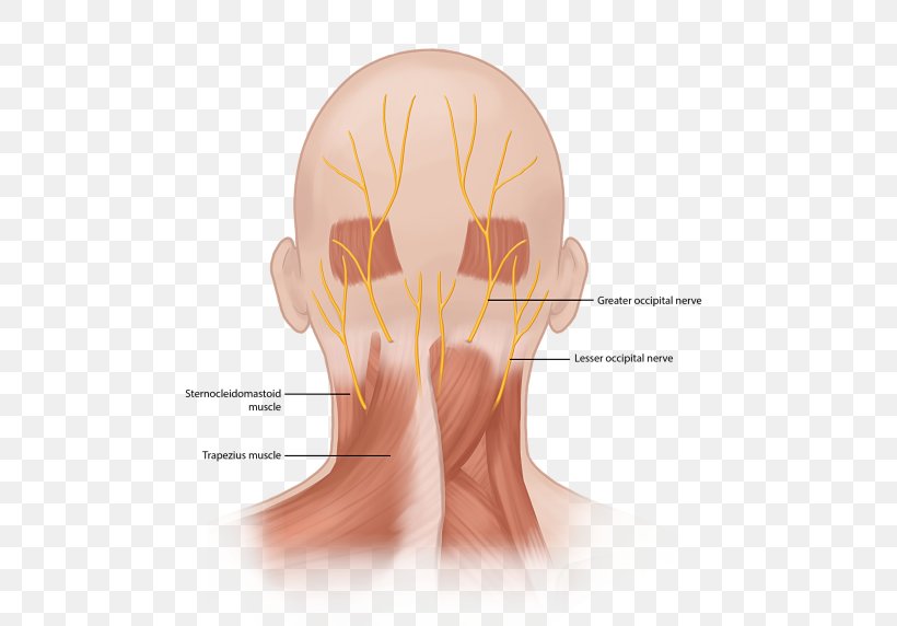 Occipital Neuralgia Greater Occipital Nerve Third Occipital Nerve, PNG, 520x572px, Occipital Neuralgia, Back Pain, Chin, Chronic Pain, Ear Download Free