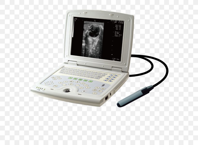 3D Ultrasound Ultrasonography Diagnostic Ultrasound Equine Ultrasound, PNG, 586x600px, 3d Ultrasound, Ultrasound, Communication, Diagnostic Ultrasound, Doppler Ultrasonography Download Free