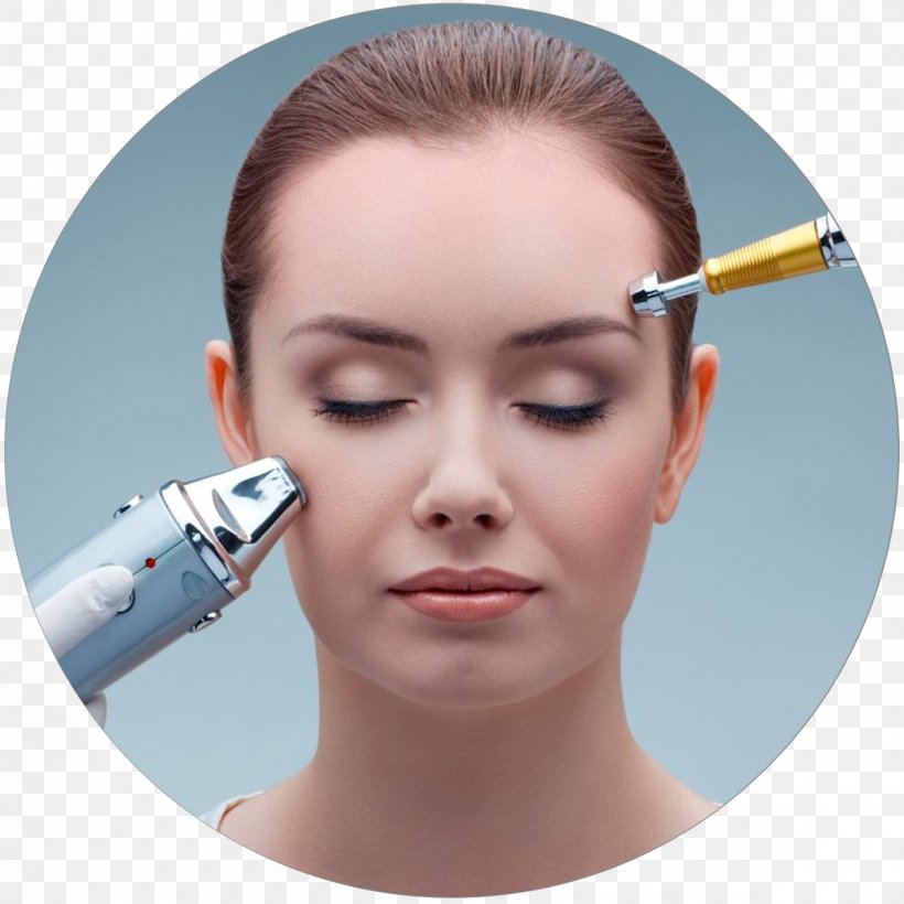 Laser Surgery Skin Photorejuvenation Therapy, PNG, 1200x1200px, Laser Surgery, Acne, Beauty, Cheek, Chin Download Free