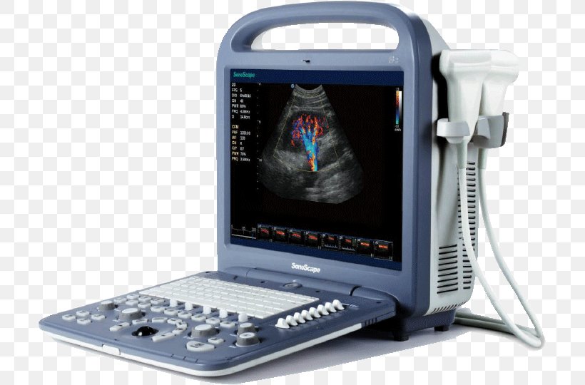 Doppler Echocardiography Portable Ultrasound Ultrasonography SonoScape Medical Corp, PNG, 711x540px, 3d Ultrasound, Doppler Echocardiography, Display Device, Echocardiography, Elastography Download Free