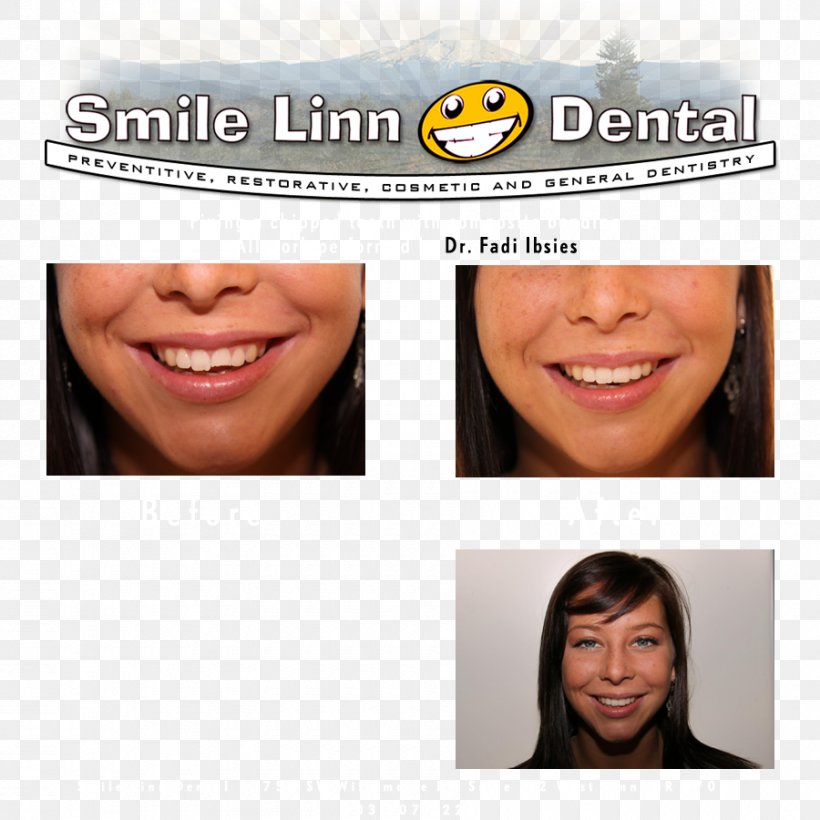 Lake Oswego Smile Linn Dental: Ibsies Fadi B DMD Willamette River Dentist Willamette, Oregon, PNG, 900x900px, Lake Oswego, Cheek, Chin, Dentist, Dentistry Download Free