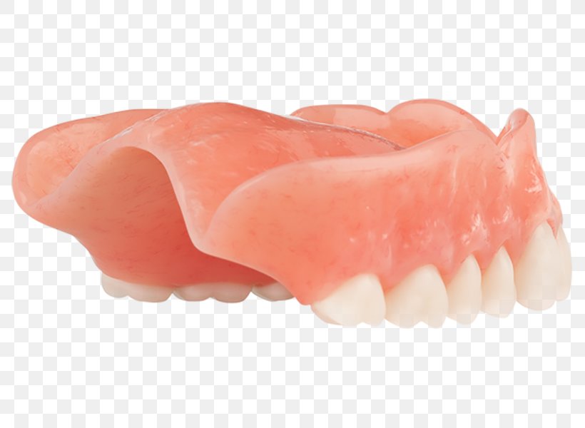 Tooth Dentures, PNG, 800x600px, Tooth, Dentures, Jaw, Mouth, Peach Download Free