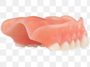 Aspen Dental - Tooth Dentures PNG