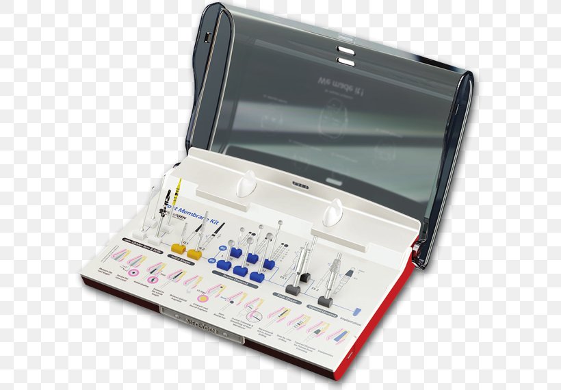 Membrane Implant Rooting Phase Path, PNG, 600x570px, Membrane, Cost, Dental Extraction, Electronics, Extraction Download Free