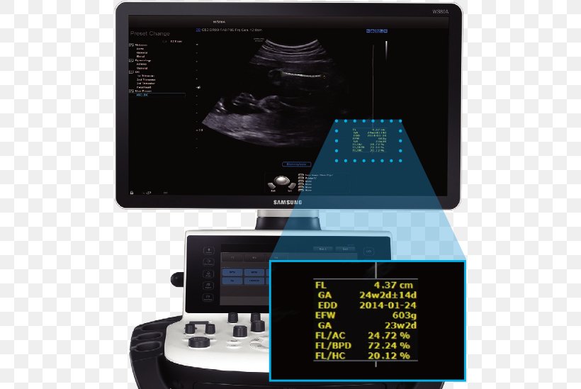 3D Ultrasound Samsung Medison Ultrasonography Consumer Electronics, PNG, 610x549px, 3d Ultrasound, Consumer Electronics, Contrastenhanced Ultrasound, Display Device, Electronics Download Free