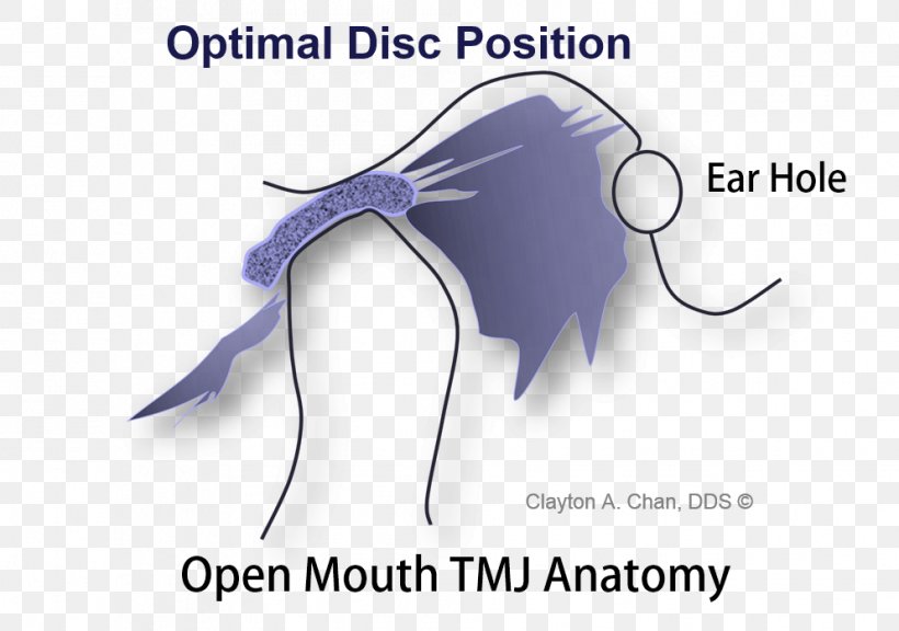 Temporomandibular Joint Dysfunction Anatomy Mandible, PNG, 993x698px, Watercolor, Cartoon, Flower, Frame, Heart Download Free