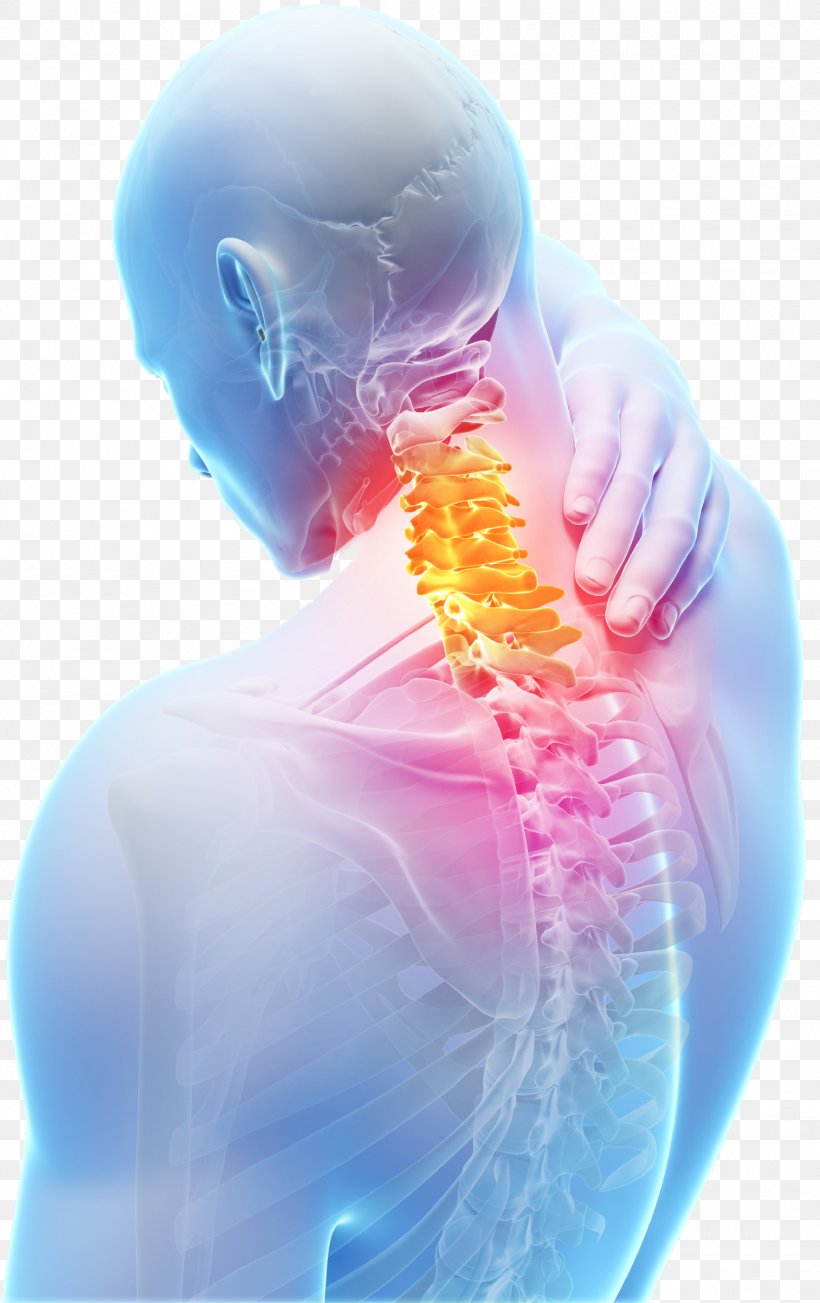Neck Pain Spinal Disc Herniation Cervical Vertebrae Vertebral Column Degenerative Disc Disease, PNG, 1513x2405px, Neck Pain, Back Pain, Cervical, Cervical Vertebrae, Chronic Pain Download Free