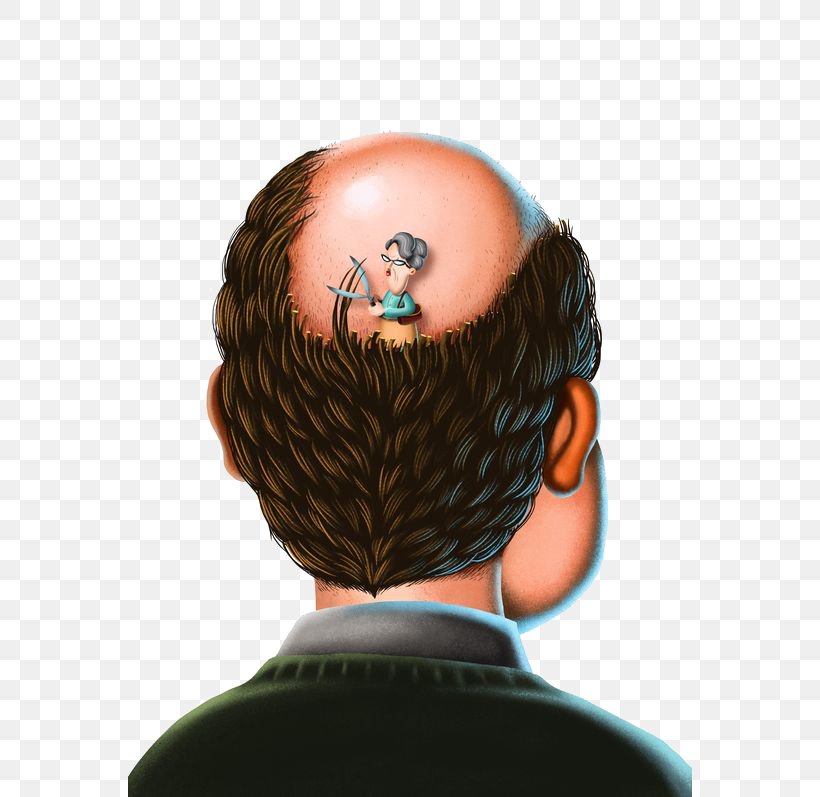 Hair Loss Botak, PNG, 564x797px, Hair Loss, Botak, Cartoon, Chin, Designer Download Free