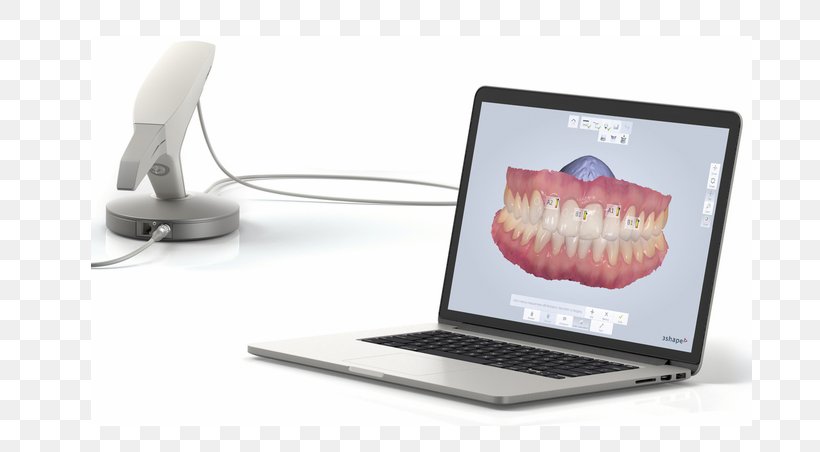 3Shape Image Scanner Dentistry 3D Scanner, PNG, 719x452px, 3d Scanner, Image Scanner, Computer Monitor Accessory, Cone Beam Computed Tomography, Crown Download Free