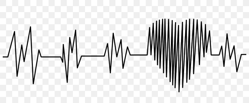 Electrocardiography Heart Rate Cardiology Pulse, PNG, 802x340px, Electrocardiography, Acute Myocardial Infarction, Black And White, Cardiac Cycle, Cardiac Monitoring Download Free
