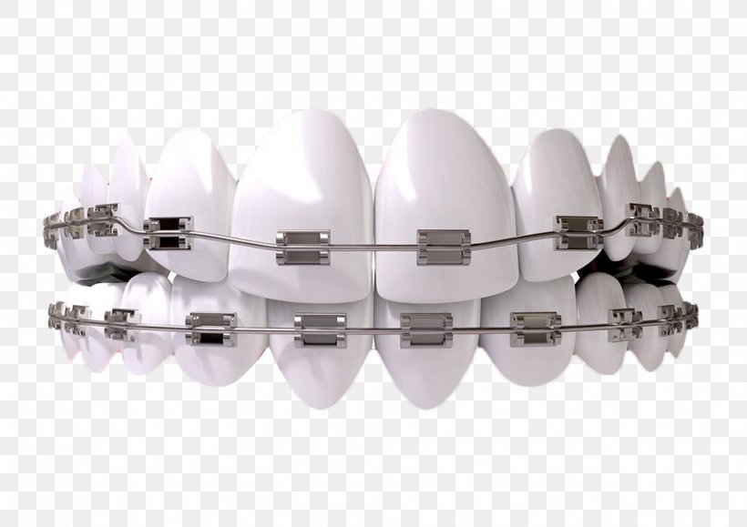 Dentistry Orthodontics Human Tooth Clinic, PNG, 1024x724px, Dentistry, Dental Braces, Dental Implant, Dental Public Health, Dental Restoration Download Free