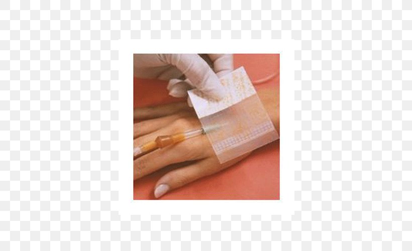 Intravenous Therapy Dressing Catheter Cannula Health Care, PNG, 500x500px, Intravenous Therapy, Arm, Bandage, Cannula, Catheter Download Free