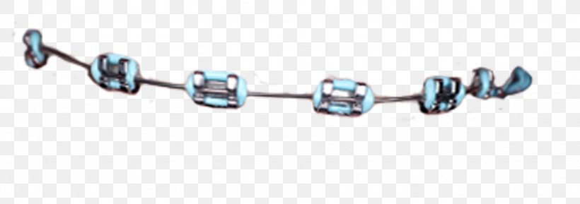 Human Tooth Car Pixel, PNG, 872x308px, Tooth, Auto Part, Bead, Body Jewelry, Car Download Free