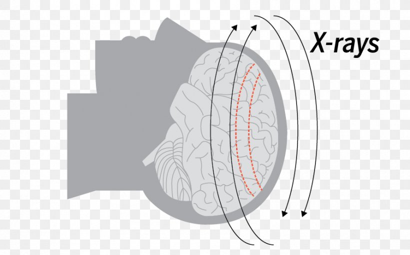 Product Design Angle Line Pattern, PNG, 889x555px, Diagram, Text Download Free