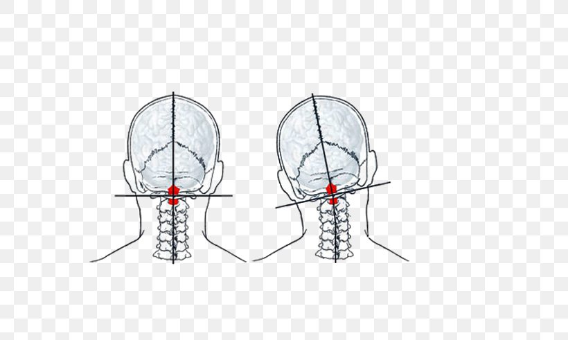 Atlas Cervical Vertebrae Vertebral Column Chiropractic Neck, PNG, 730x491px, Watercolor, Cartoon, Flower, Frame, Heart Download Free