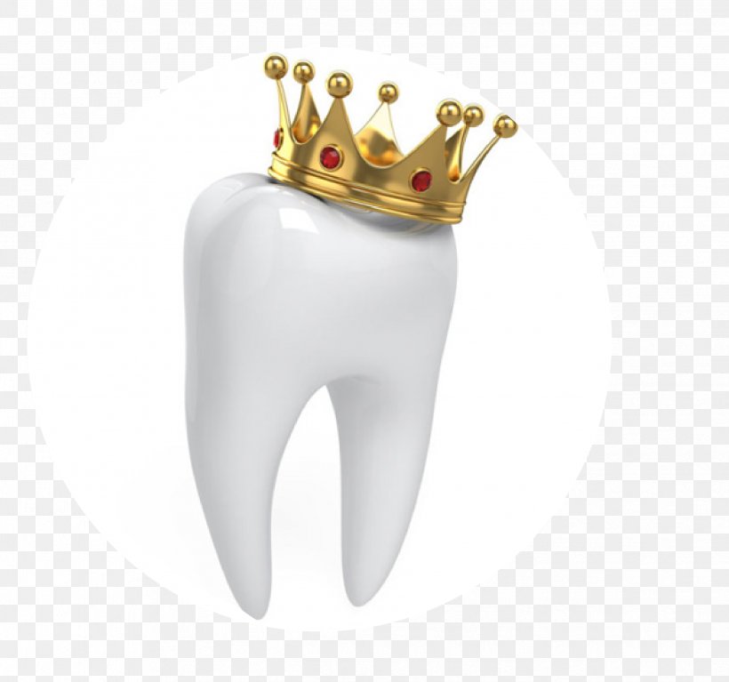 Crown Dentistry Human Tooth, PNG, 2482x2324px, Crown, Antler, Body Jewelry, Bridge, Cadcam Dentistry Download Free