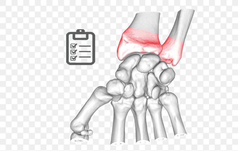 Thumb Elbow Bone Ulnar Nerve Joint, PNG, 522x522px, Watercolor, Cartoon, Flower, Frame, Heart Download Free