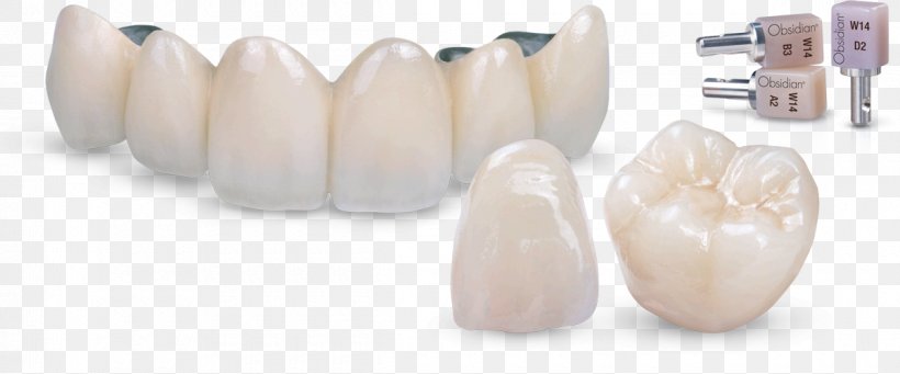 Tooth Ceramic Crown Dental Porcelain, PNG, 1200x500px, Tooth, Ceramic, Ceramic Art, Ceramist, Crown Download Free