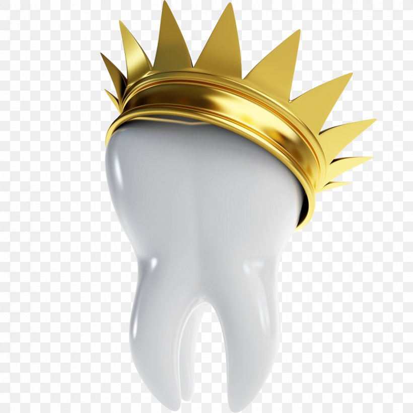 Dentistry Bridge Crown Dental Implant, PNG, 1200x1200px, Dentistry, Bridge, Cosmetic Dentistry, Crown, Dental Anatomy Download Free