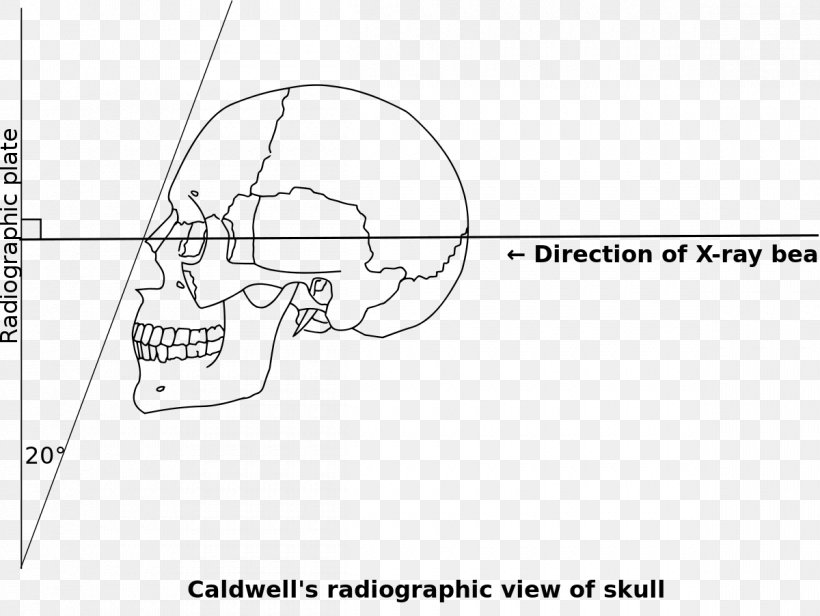 Caldwell's View Orbitomeatal Line /m/02csf Document Angle, PNG, 1200x902px, Watercolor, Cartoon, Flower, Frame, Heart Download Free