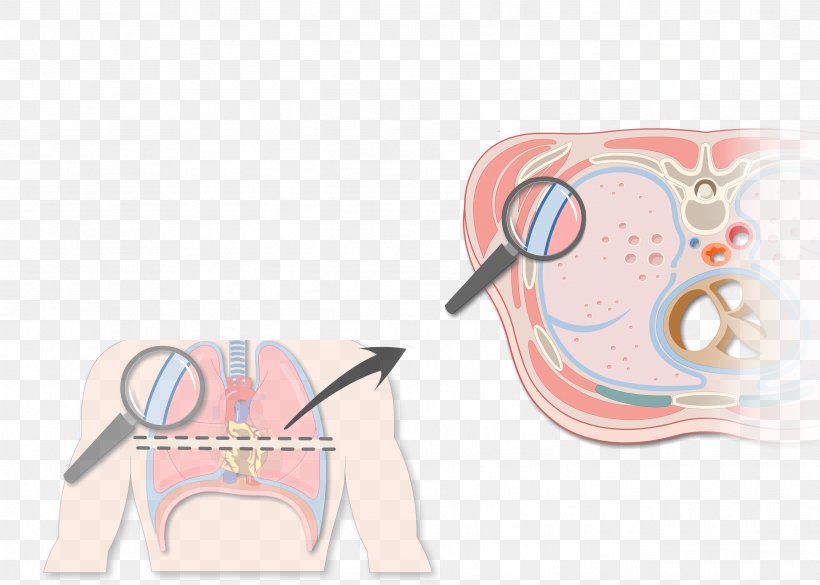 Pulmonary Pleurae Pleural Cavity Thoracic Cavity Pleural Effusion Lung, PNG, 2591x1851px, Watercolor, Cartoon, Flower, Frame, Heart Download Free