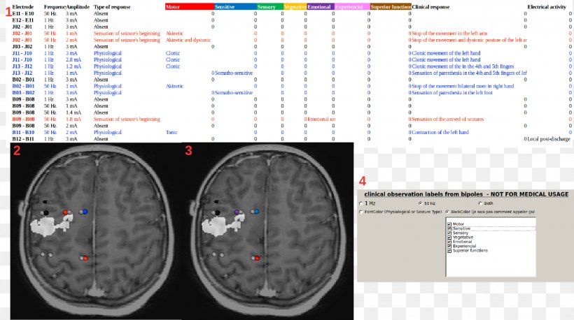 Medical Imaging Brain Positron Emission Tomography Magnetic Resonance Imaging Electrode, PNG, 2250x1258px, Watercolor, Cartoon, Flower, Frame, Heart Download Free