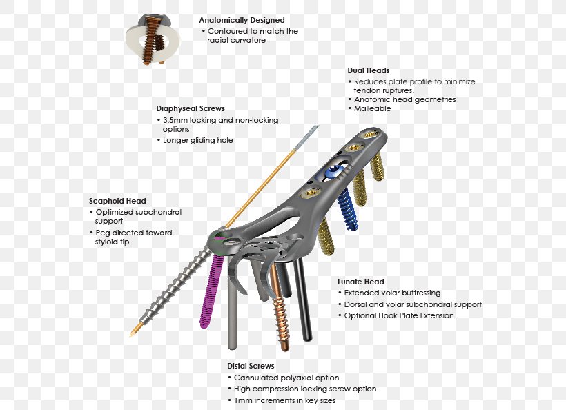 Skeletal Dynamics Inc Bone Radius Distal Human Skeleton, PNG, 650x594px, Bone, Axial Skeleton, Compression, Distal, Distal Radius Fracture Download Free