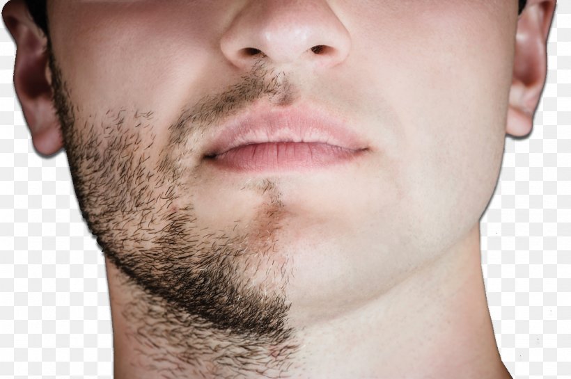 Shaving Electric Razors & Hair Trimmers Beard Face, PNG, 1124x748px, Shaving, Aftershave, Beard, Cheek, Chin Download Free