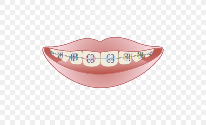 矯正歯科 Dentistry Dental Braces Mouthguard, PNG, 500x500px, Dentist, Clinic, Damon System, Dental Braces, Dentistry Download Free