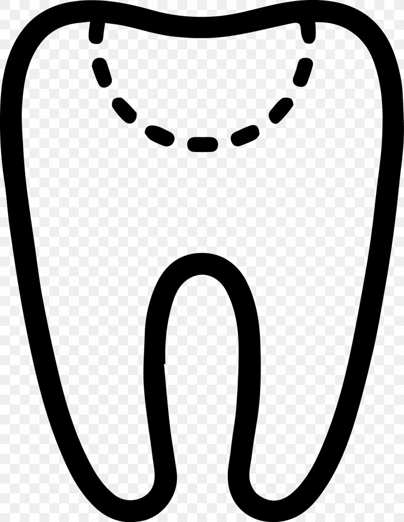 Dentistry Periodontal Probe Tooth Amalgam, PNG, 1467x1893px, Dentistry, Amalgam, Black, Black And White, Crown Download Free