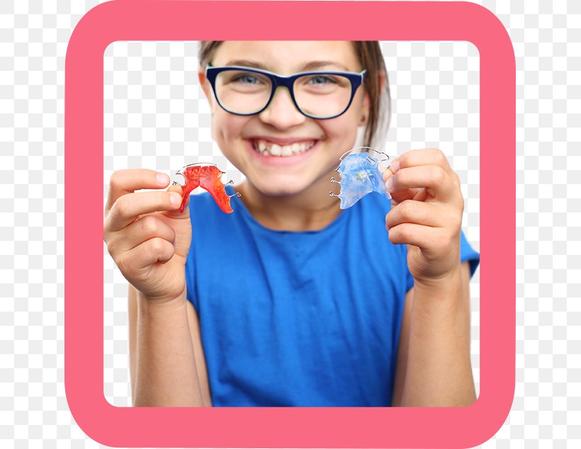 Orthodontics Dental Braces Dentistry Child, PNG, 726x634px, Orthodontics, Child, Crowding Of Teeth, Dental Arch, Dental Braces Download Free