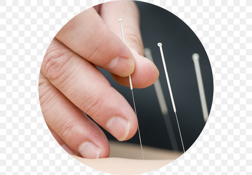 Acupuncture Traditional Chinese Medicine Naturopathy Dry Needling, PNG, 570x570px, Acupuncture, Alternative Health Services, Clinic, Doctor Of Medicine, Dry Needling Download Free