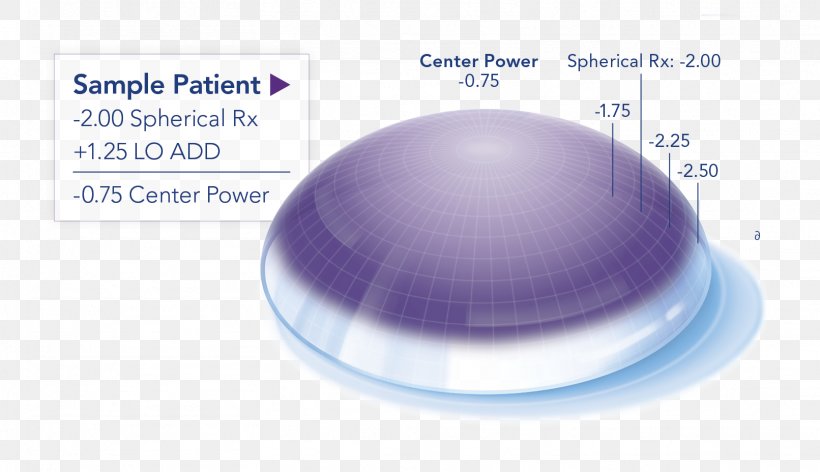 Contact Lenses Progressive Lens O2 Optix Toric Lens, PNG, 1612x928px, Contact Lenses, Disposable, Education, Eye, Lens Download Free