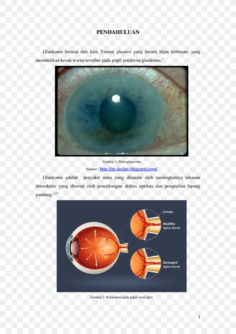 Close-up Optic Nerve, PNG, 1653x2339px, Watercolor, Cartoon, Flower, Frame, Heart Download Free