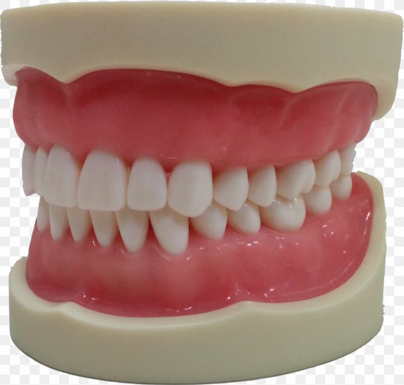 Human Tooth Jaw Typodont Gums, PNG, 853x813px, Tooth, Dentist, Dentistry, Gums, Health Beauty Download Free