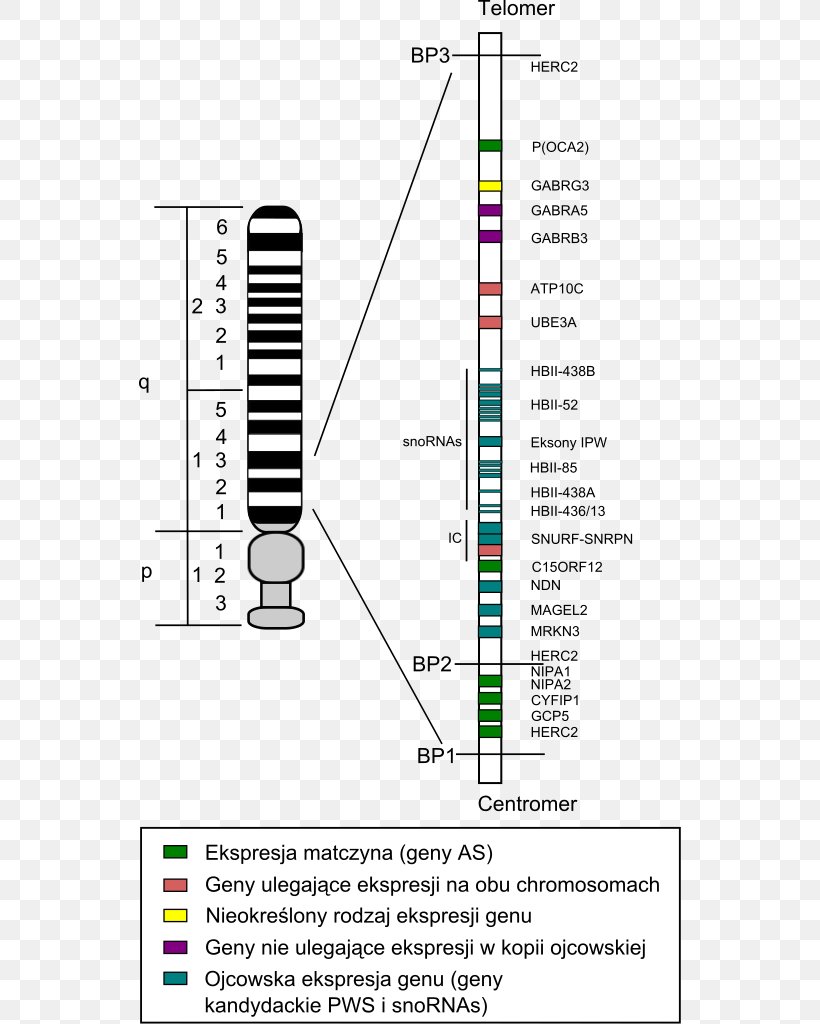 Genetic Disorder Chromosome Disease Down Syndrome, PNG, 542x1024px, Genetic Disorder, Birth Defect, Chromosome, Chromosome 15 Human, Chromosome Abnormality Download Free