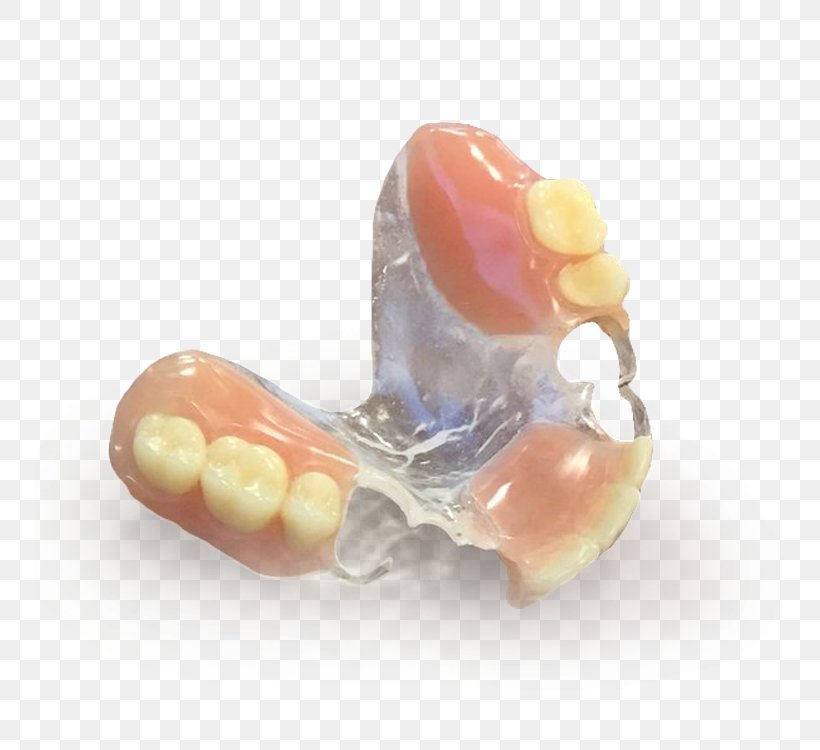 Dentures Tooth Dentistry Manufacturing Dental Impression, PNG, 750x750px, Dentures, Dental Impression, Dentistry, High Tech, Industry Download Free