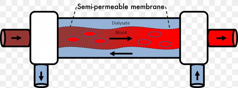 Hemodialysis Transmembrane Protein Pressure, PNG, 1410x525px, Hemodialysis, Area, Calculation, Clearance, Cost Download Free