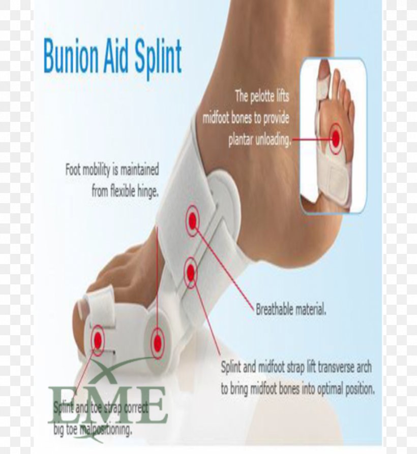 Bunion Shoe Foot Ankle Toe, PNG, 917x1000px, Watercolor, Cartoon, Flower, Frame, Heart Download Free