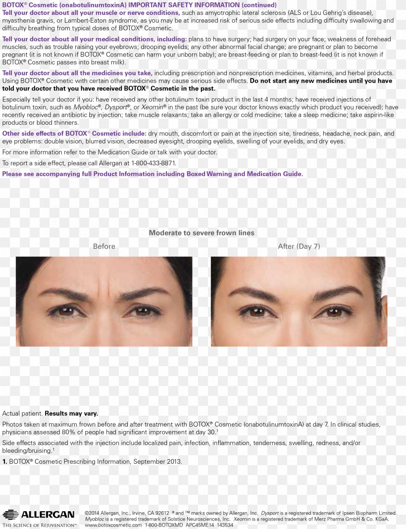 Botulinum Toxin Injection Wrinkle Surgery, PNG, 2367x3088px, Botulinum Toxin, Blepharoplasty, Cheek, Chin, Clostridium Botulinum Download Free