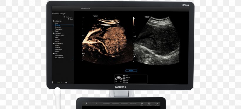 Contrast Agent Ultrasonography Ultrasound Radiography Medical Imaging, PNG, 1240x563px, Contrast Agent, Artery, Blood Vessel, Computed Tomography, Computer Monitor Download Free
