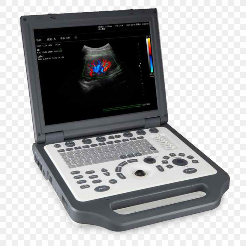 Ultrasonography Ultrasound Doppler Echocardiography Medical Equipment Medicine, PNG, 1200x1200px, Ultrasonography, Doppler Echocardiography, Doppler Fetal Monitor, Electronic Device, Electronic Instrument Download Free