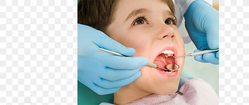 Pediatric Dentistry Cosmetic Dentistry Dental Implant, PNG, 741x347px, Dentist, Cheek, Child, Chin, Clear Aligners Download Free