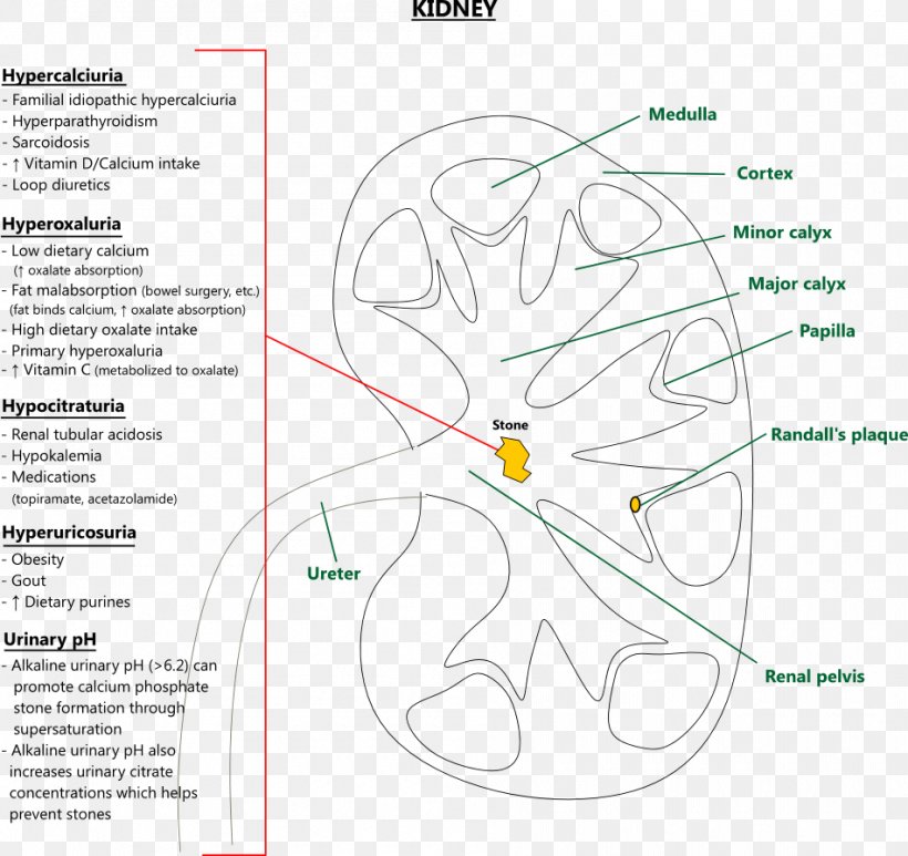 Uric Acid Kidney Stone Urine Joint, PNG, 950x896px, Watercolor, Cartoon, Flower, Frame, Heart Download Free