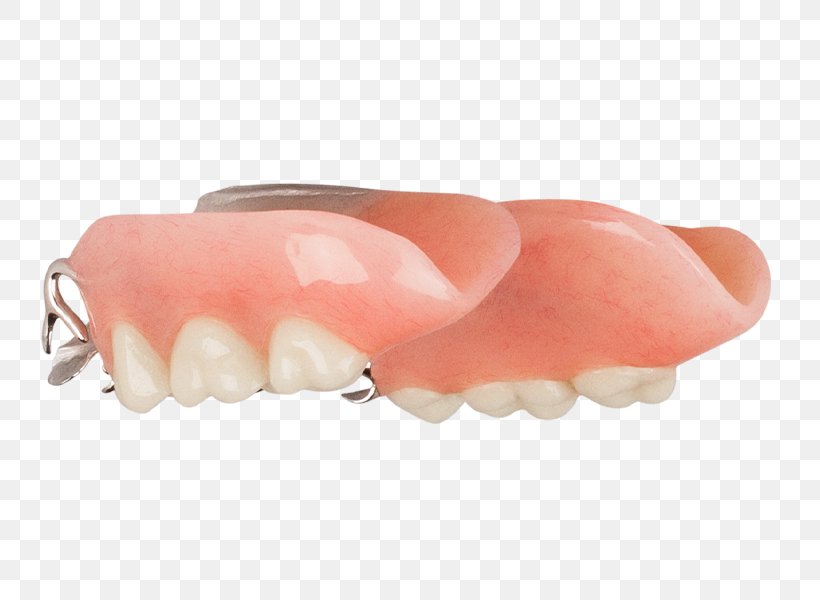 Tooth Removable Partial Denture Dentures Dentistry Aspen Dental, PNG, 749x600px, Tooth, Aspen Dental, Dentistry, Dentures, Finger Download Free