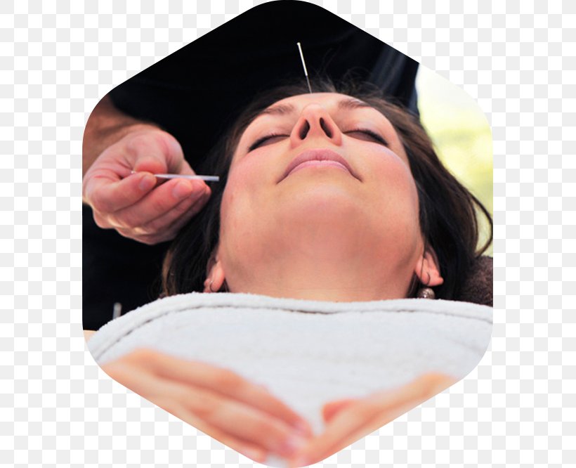 Arbour Acupuncture Chin Cheek Bodywork, PNG, 585x666px, Acupuncture, Bodywork, Cheek, Chin, Clinic Download Free