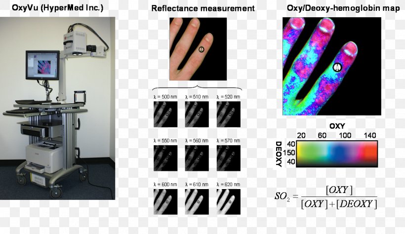 Journal Of Biomedical Optics Hyperspectral Imaging Biomedical Engineering Diabetic Foot, PNG, 1125x651px, Hyperspectral Imaging, Biomedical Engineering, Biomedical Technology, Brand, Diabetes Mellitus Download Free